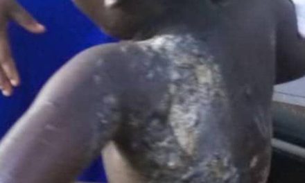 Woman Grabbed For Burning Daughter Over GHC5 Akpeteshie