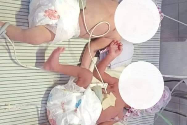 Quadruplets Delivered Through SC In Koforidua<span class="wtr-time-wrap after-title"><span class="wtr-time-number">1</span> min read</span>