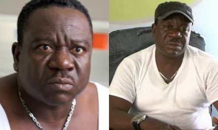 Mr Ibu Suffers Amputation, Family Says It Is To Keep Him alive