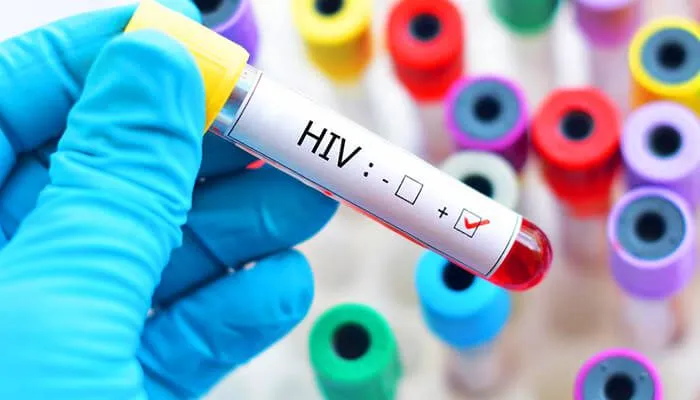17,774 New HIV Infections Recorded in Ghana in 2023<span class="wtr-time-wrap after-title"><span class="wtr-time-number">1</span> min read</span>